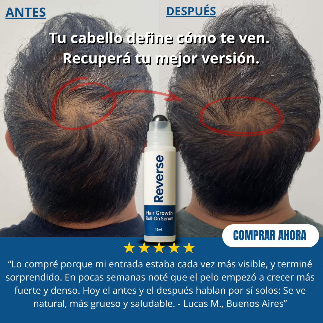 Serum Roll-On para el Crecimiento Capilar - Reverse