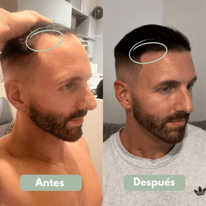 Reverse - Serum Roll-On para el Crecimiento Capilar